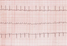 Desafío ECG 14