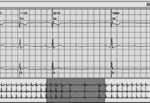 Desafío ECG 15